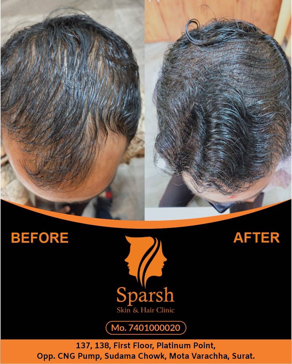 Sparsh Skin, Hair & Laser Clinic 