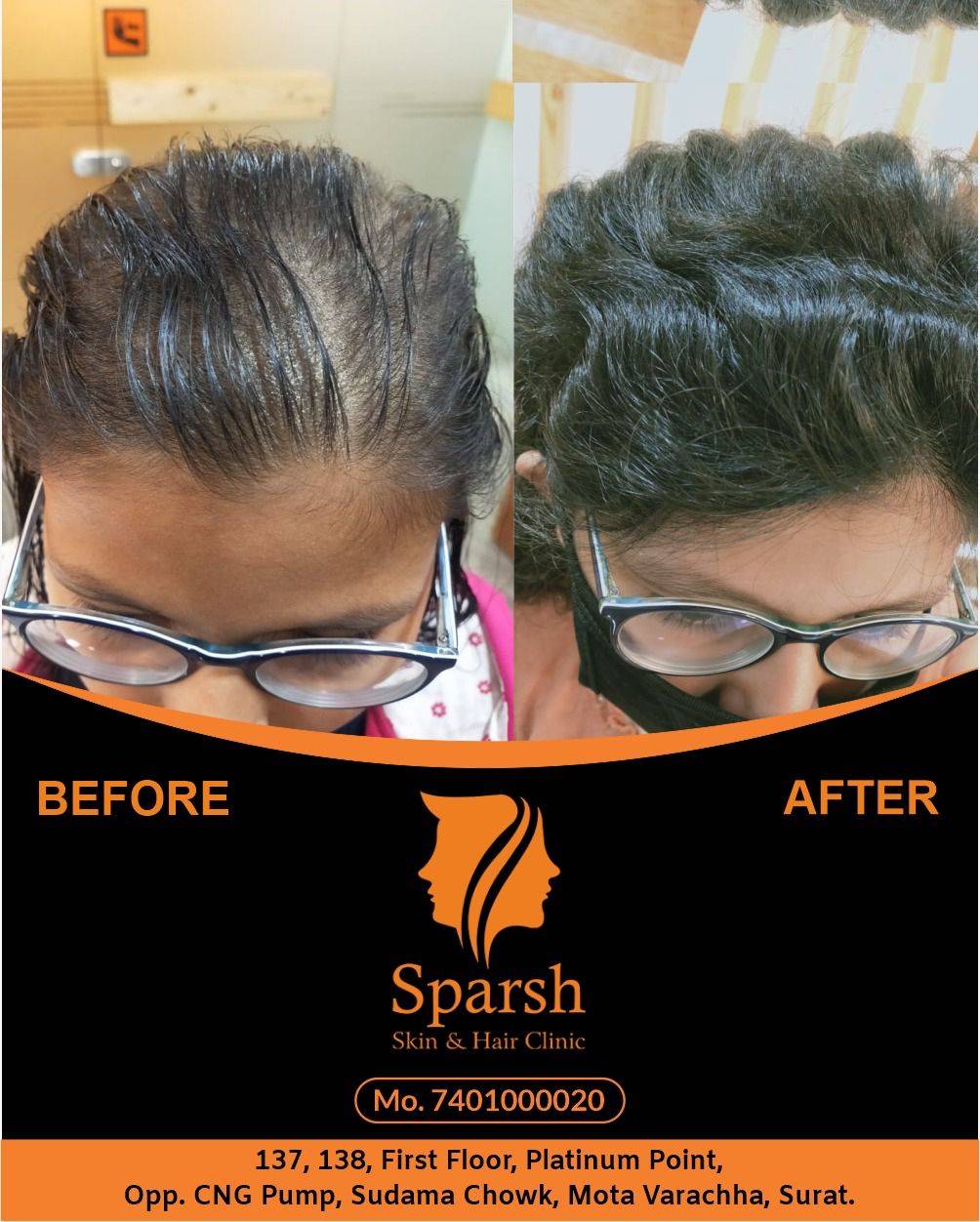 Sparsh Skin, Hair & Laser Clinic 